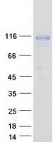 Human QRICH1 Protein (Recombinant Myc-DDK (Flag))