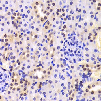 Polyclonal Rabbit anti-Human HNRPA1 / HnRNP A1 Antibody (IHC, IF, WB)