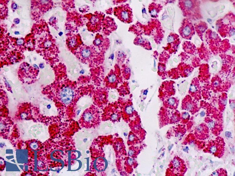 IHC-plus™ ACAT1 Antibody (clone AT2C5)