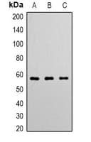 Polyclonal Rabbit anti-Human ANGPT1 / Angiopoietin-1 Antibody (N-Terminus, WB)