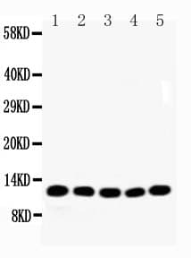 Polyclonal Rabbit anti-Human NDUFA1 Antibody (aa54-70, IHC, WB)