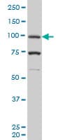 PR / Progesterone Receptor Antibody (clone 1B11)