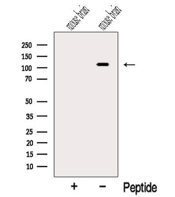 Polyclonal Rabbit anti-Human OGDHL Antibody (WB)