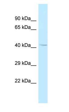 CENTG2 / AGAP1 Antibody (aa302-351)