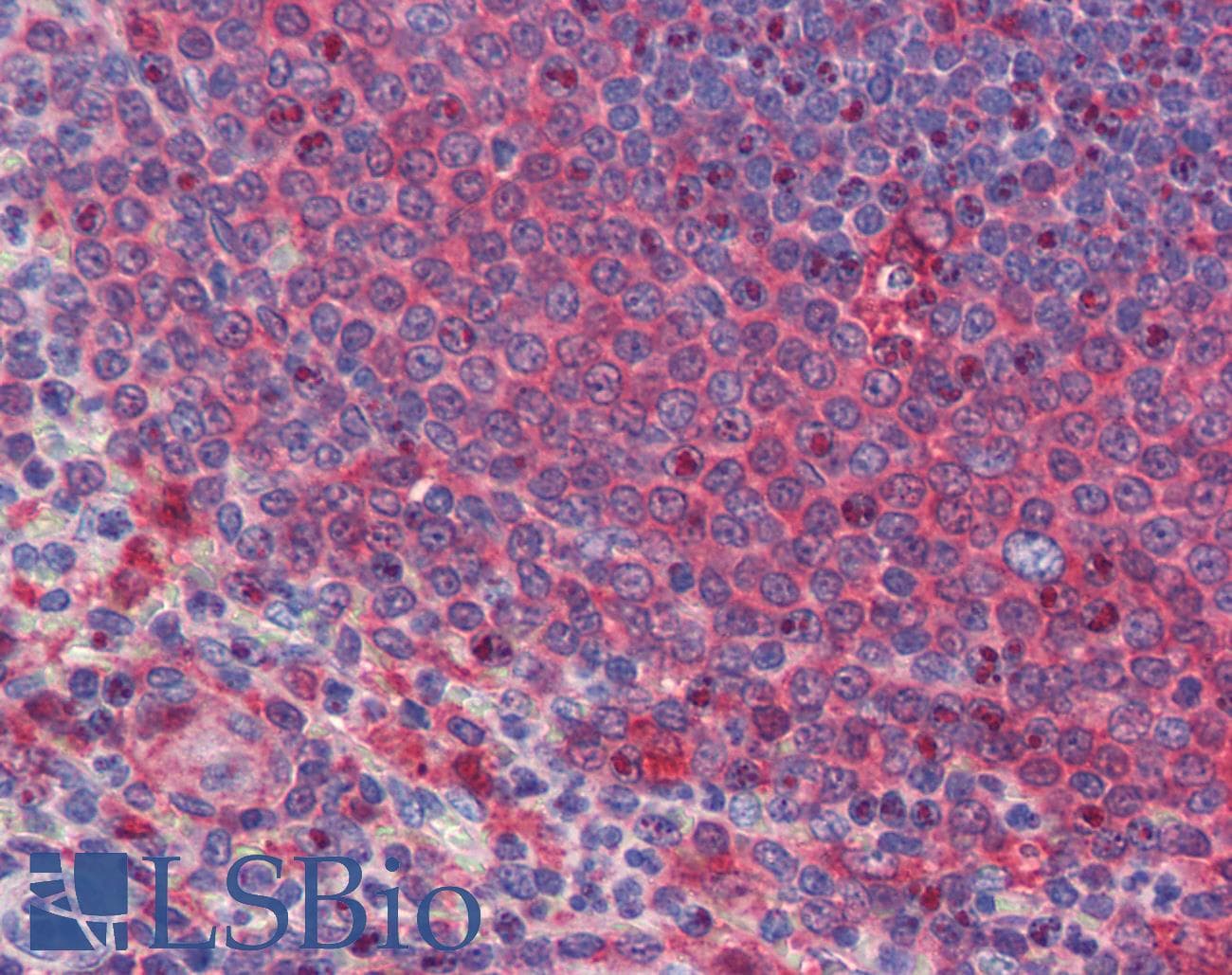 IHC-plus™ DPR2 / DACT2 Antibody