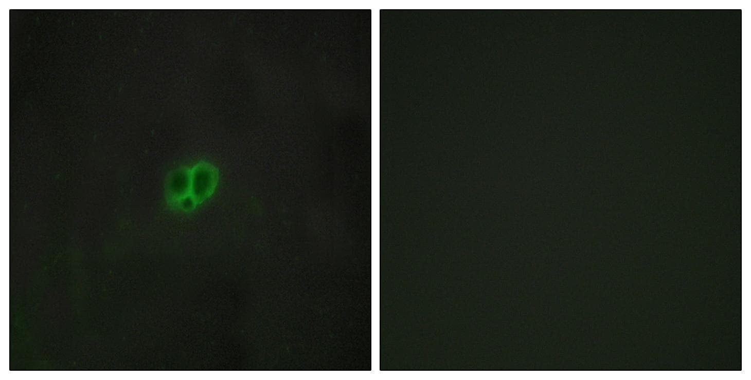 CRFR1 / CRHR1 Antibody