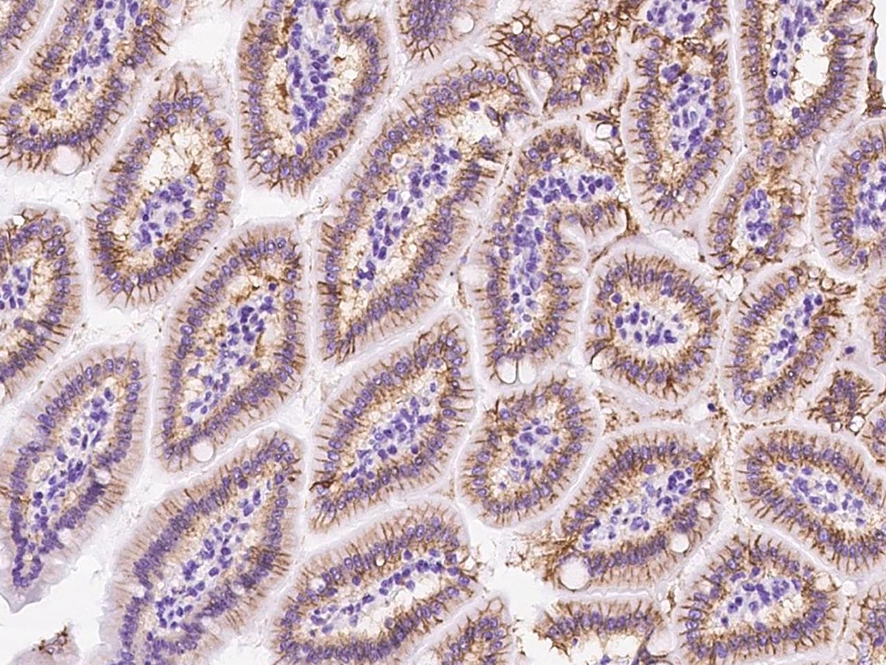 CDH17 / Cadherin 17 Antibody