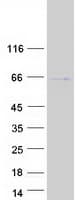 Human TUB / Tubby Protein (Recombinant Myc-DDK (Flag))