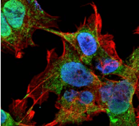 Monoclonal Mouse anti-Human VDAC1 / PORIN Antibody (clone S152B-23, IF, WB)