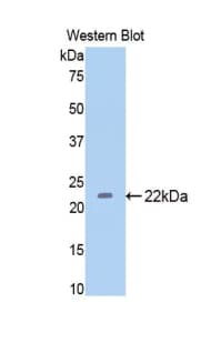THBS1 / Thrombospondin-1 Antibody (aa957-1129)