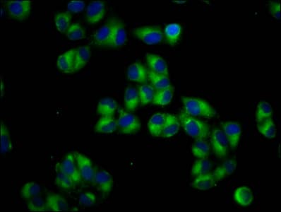 Polyclonal Rabbit anti-Human PTOV1 Antibody (IHC, IF)