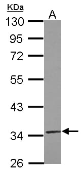 Polyclonal Rabbit anti-Human TRUB2 Antibody (WB)