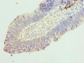 RINT1 Antibody