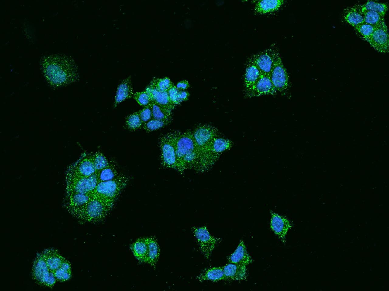 AACS Antibody