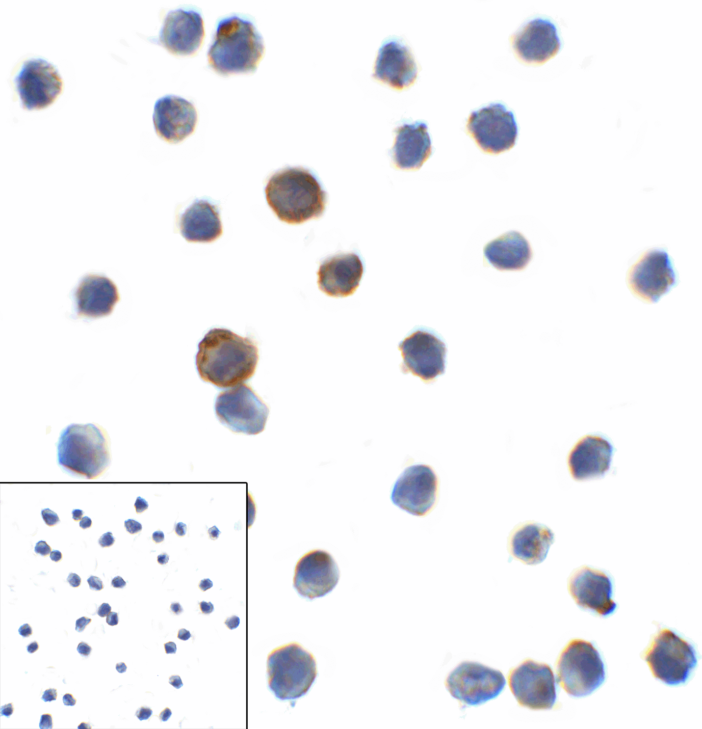 PathPlus™ Monoclonal Mouse anti-Human LAG3 Antibody (clone 9F9, IHC, IF)