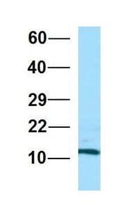 RPL36AL Antibody (C-Terminus)