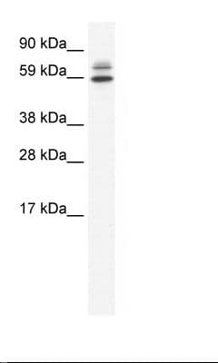 ZBTB38 Antibody (aa120-169)