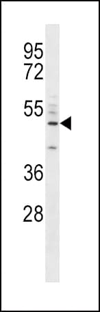 CD14 Antibody (aa292-322)
