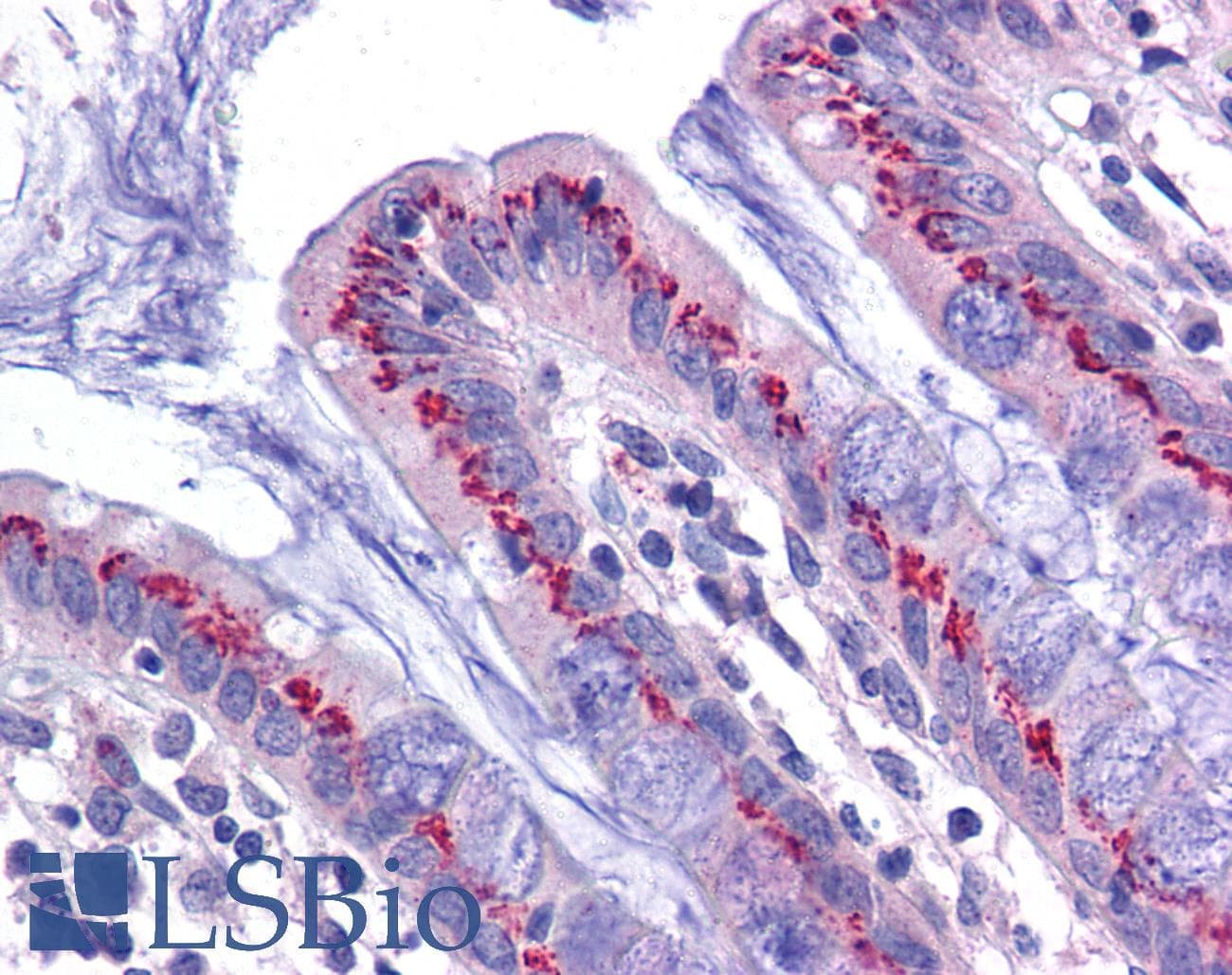 IHC-plus™ Polyclonal Rabbit anti-Human USP10 Antibody (IHC, IF, WB)