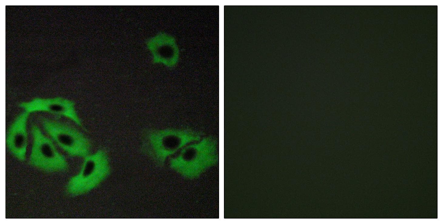 Polyclonal Rabbit anti-Human BAX Antibody (IHC, IF)