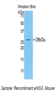 AHSG / Fetuin A Antibody (aa19-250)