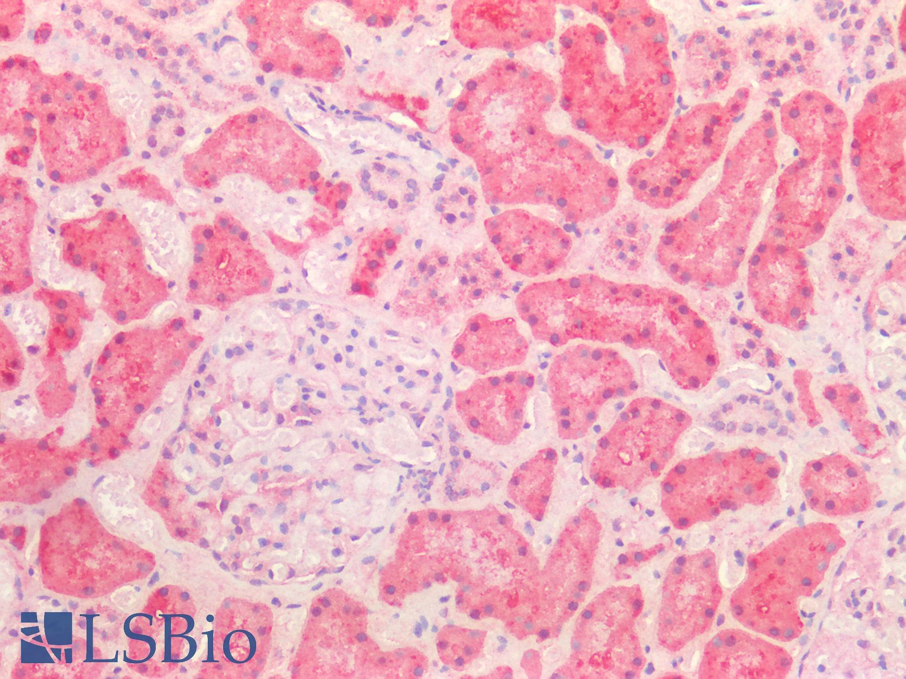PathPlus™ HSPD1 / HSP60 Antibody