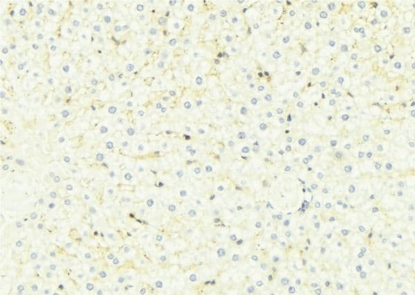 HSD11B1 / HSD11B Antibody