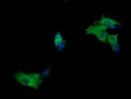 MAP2K1 / MKK1 / MEK1 Antibody (clone OTI8H1)