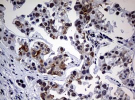 Monoclonal Mouse anti-Human NBN / Nibrin Antibody (clone OTI2G4, IHC, WB)