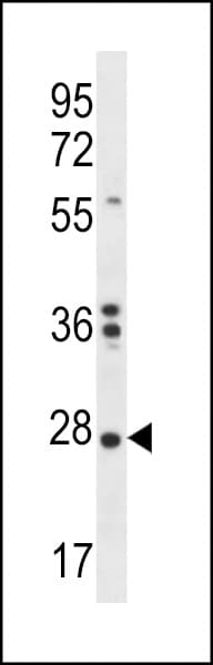 NKAIN1 Antibody (aa157-186)