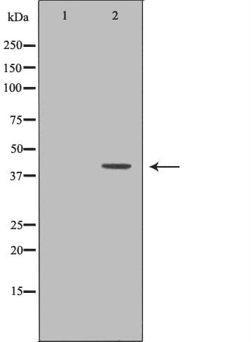 AHSG / Fetuin A Antibody
