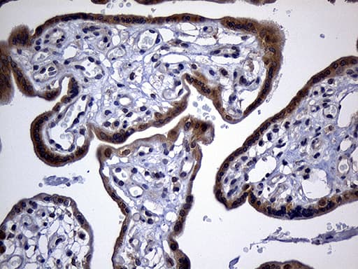 Monoclonal Mouse anti-Human IMP-3 / IGF2BP3 Antibody (clone OTI6A4, Carrier-free, IHC, WB)