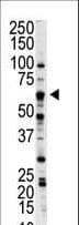 NLK Antibody (aa406-436)
