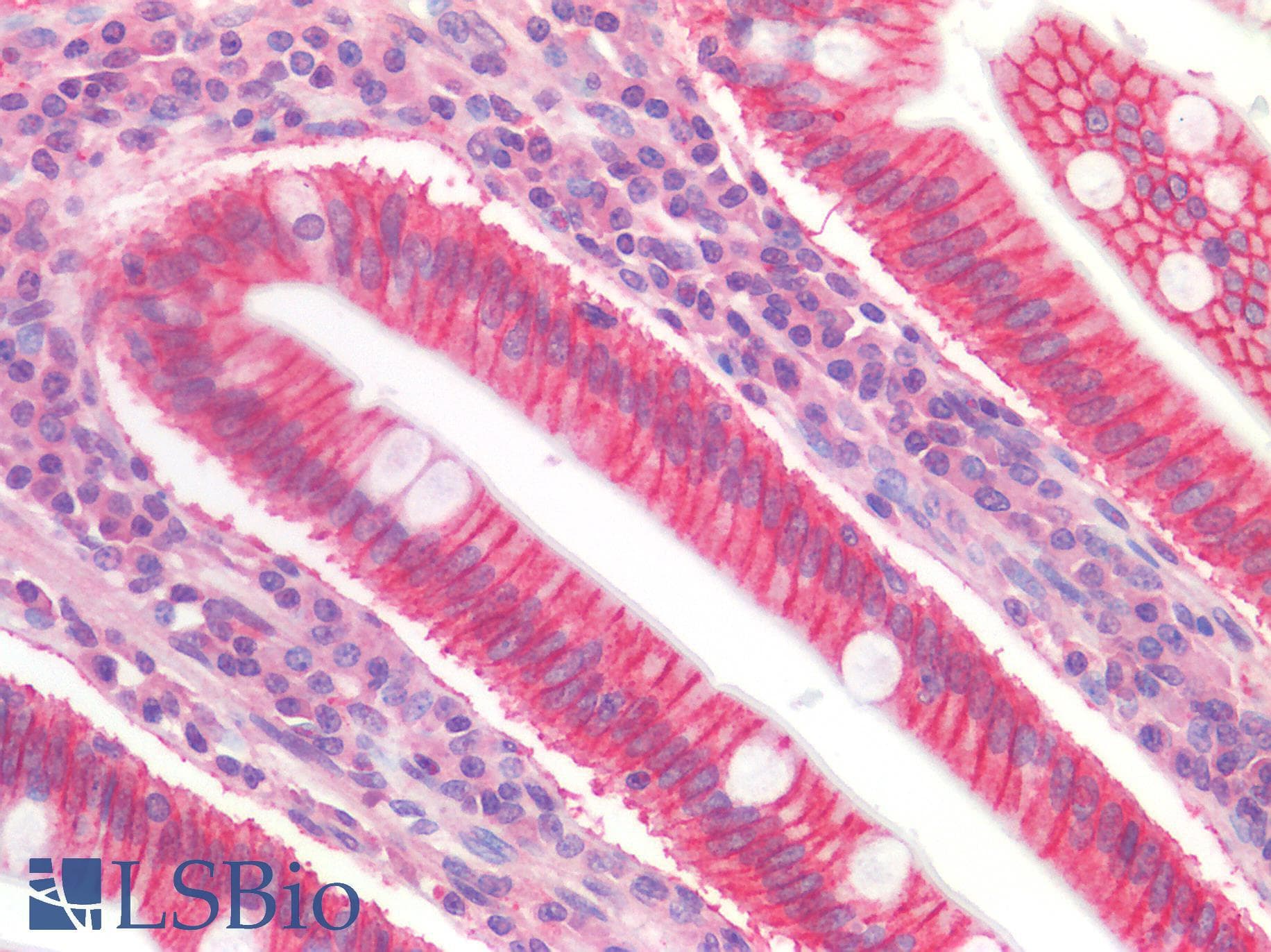 IHC-plus™ Polyclonal Rabbit anti-Human TNFSF4 / OX40L / CD252 Antibody (IHC)