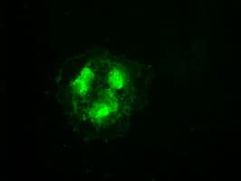 Monoclonal Mouse anti-Human CDK5 Antibody (clone OTI2H6, IF, WB)