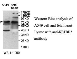 Polyclonal Rabbit anti-Human KBTBD2 Antibody (aa209-394, WB)