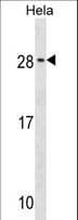 RAB35 Antibody (aa171-199)