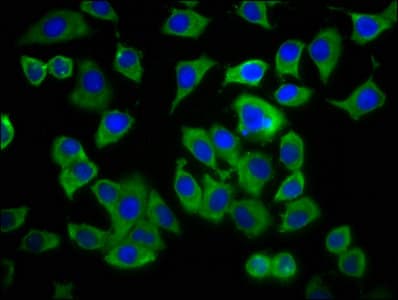 ADCY8 / Adenylate Cyclase 8 Antibody