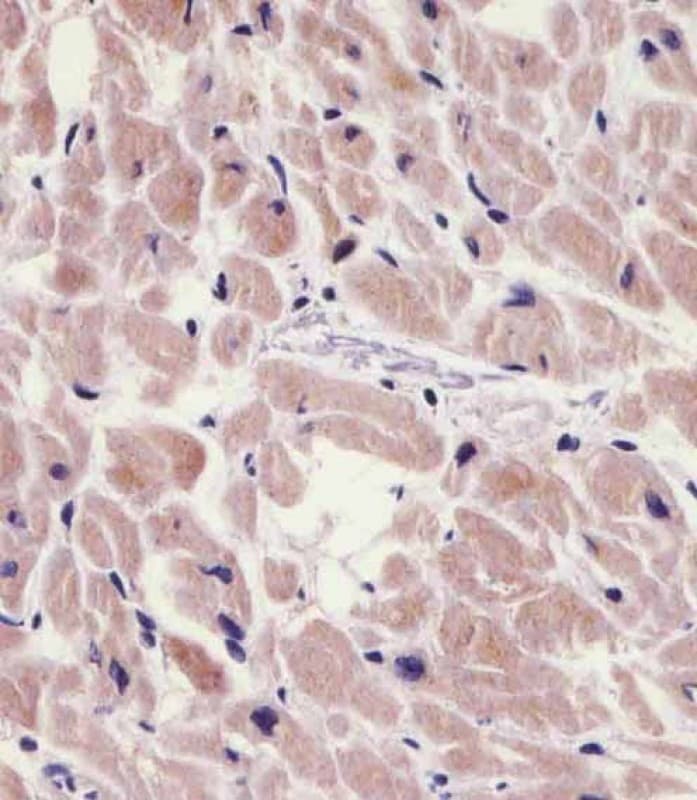 Polyclonal Rabbit anti-Human PKN1 Antibody (C-Terminus, IHC, IF, WB)