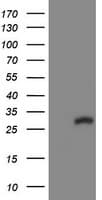 COMMD1 Antibody (clone OTI1G7)