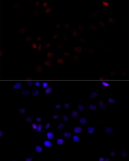 Polyclonal Rabbit anti-Human TBP / GTF2D Antibody (IF)