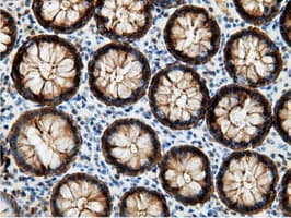 EPHX2 / Epoxide Hydrolase 2 Antibody (clone OTI1H5)