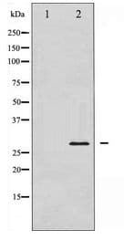 Polyclonal Rabbit anti-Human TNNI3 / Cardiac Troponin I Antibody (IHC, WB)