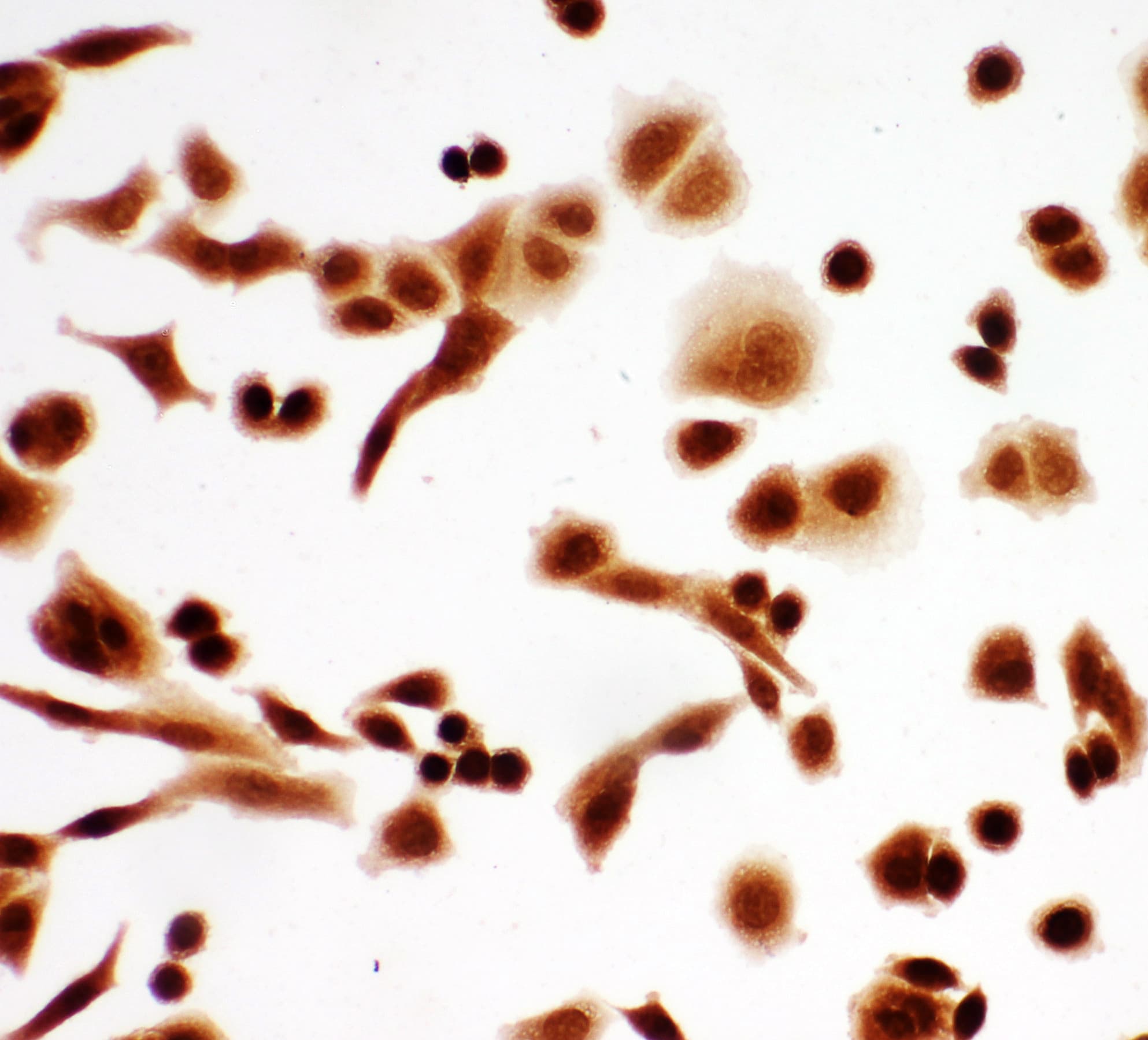 TP63 / p63 Antibody (aa664-680)