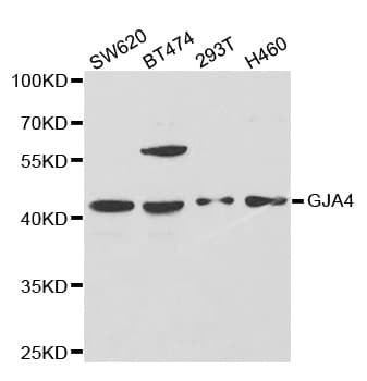 GJA4 / CX37 / Connexin 37 Antibody