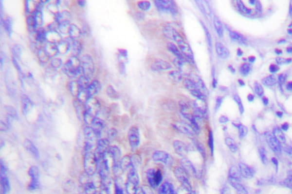 Polyclonal Rabbit anti-Human WASF1 / WAVE Antibody (Ile119, IHC, IF, WB)
