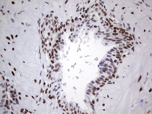 HDAC9 Antibody (aa181-460, clone OTI7G2, Carrier-free)
