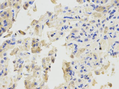 BTC / Betacellulin Antibody