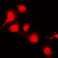 PTK6 / BRK Antibody
