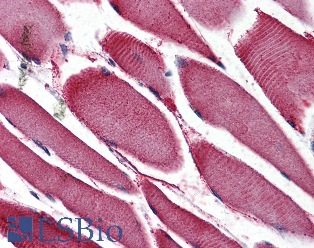 PathPlus™ Nor-1 / NR4A3 Antibody (Internal)